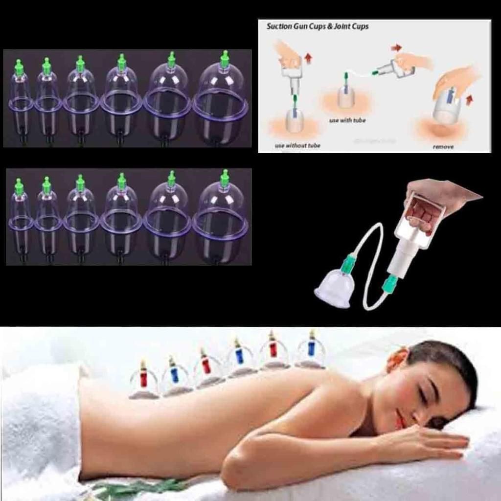 ZS - Vacuum Cupping Sets of 12 Cups With Pump